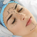 The Benefits of Cosmetic Surgeons in Beverly Hills CA