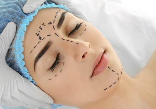 The Benefits of Cosmetic Surgeons in Beverly Hills CA